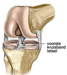 Kruisbanden in knie